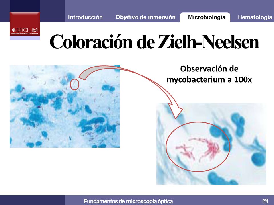 TINCION ZIEHL NEELSEN FUNDAMENTO EBOOK TINCION ZIEHL NEELSEN FUNDAMENTO EBOOK